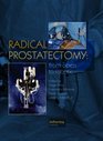 Radical Prostatectomy Principles and Practice