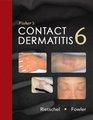 Fisher's Contact Dermatitis 6/e