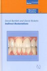 Indirect Restorations