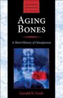 Aging Bones A Short History of Osteoporosis