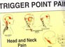 Trigger Point of Pain Wall Charts
