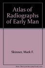 Atlas of radiographs of early man