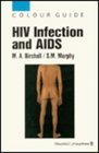 HIV Infection And AIDS