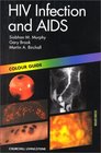 HIV Infection and AIDS