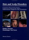 Hair and Scalp Disorders common presenting signs differential diagnosis and treatment