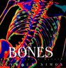 Bones