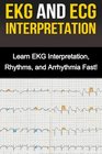 EKG and ECG Interpretation Learn EKG Interpretation Rhythms and Arrhythmia Fast