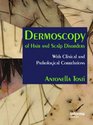 Dermoscopy of Hair and Scalp Disorders Pathological and Clinical Correlation