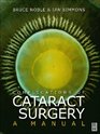 Complications of Cataract Surgery A Manual