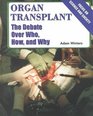 Organ Transplant The Debate over Who How and Why