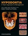 Hypodontia A Team Approach to Management