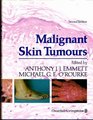Malignant Skin Tumours