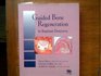 Guided Bone Regeneration in Implant Dentistry
