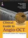 Clinical Guide to AngioOCT Non Invasive Dyeless OCT Angiography