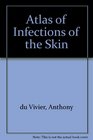 Atlas of Infections of the Skin