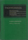 Tachycardias Mechanisms Diagnosis Treatment