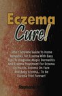 Eczema Cure The Complete Guide To Home Remedies For Eczema With Easy Tips To Diagnose Atopic Dermatitis And Eczema Treatment For Eczema On Hands Eczema On Face And Baby Eczema To Be Eczema Free