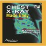 Chest Xrays Made Easy