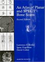 Atlas of Planar and SPECT Bone Scans