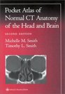 Pocket Atlas of Normal Ct Anatomy of the Head and Brain