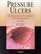Pressure Ulcers: Guidelines for Prevention and Management (Books)