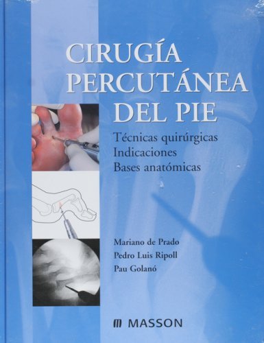 Cirugia Percutanea Del Pie Tecnicas Quirurgicas Indicaciones Bases Anatomicas Spanish Edition 9983