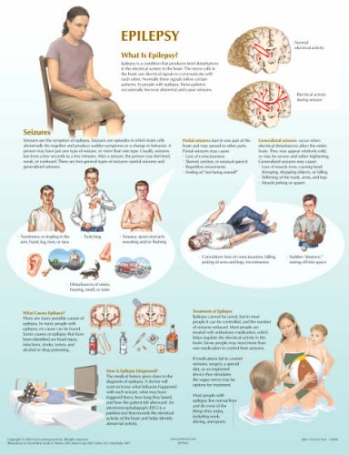 Epilepsy Chart Netter Charts Frank H Netter 1933247169 4300